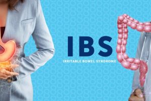 Irritable Bowel Syndrome